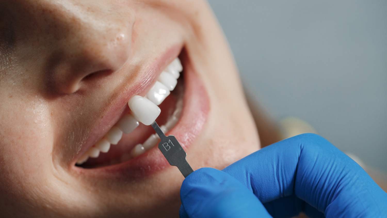 A smiling female patient sits in a modern Turkish dental clinic chair