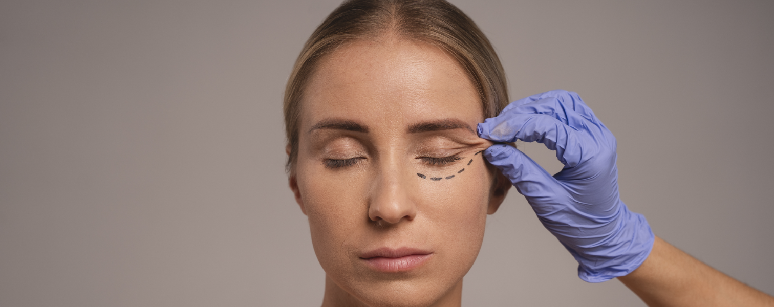 Blepharoplasty