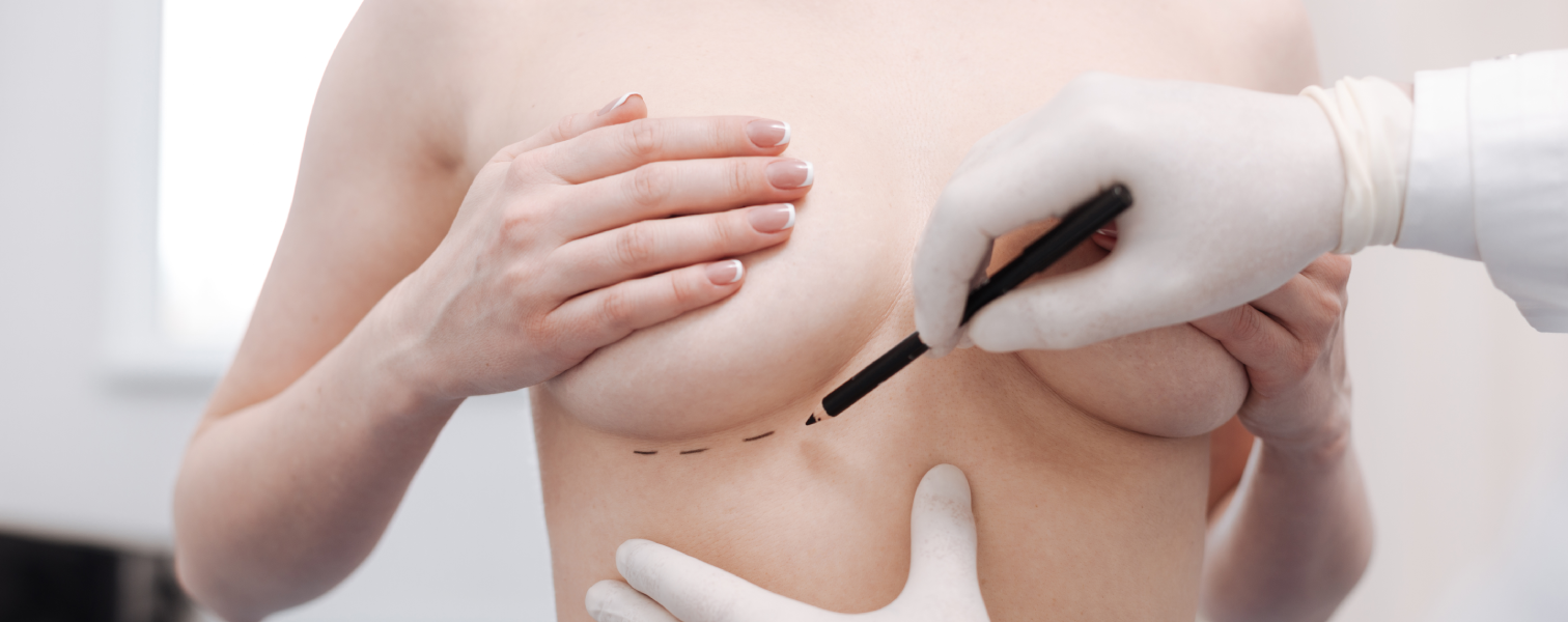 Breast Lift