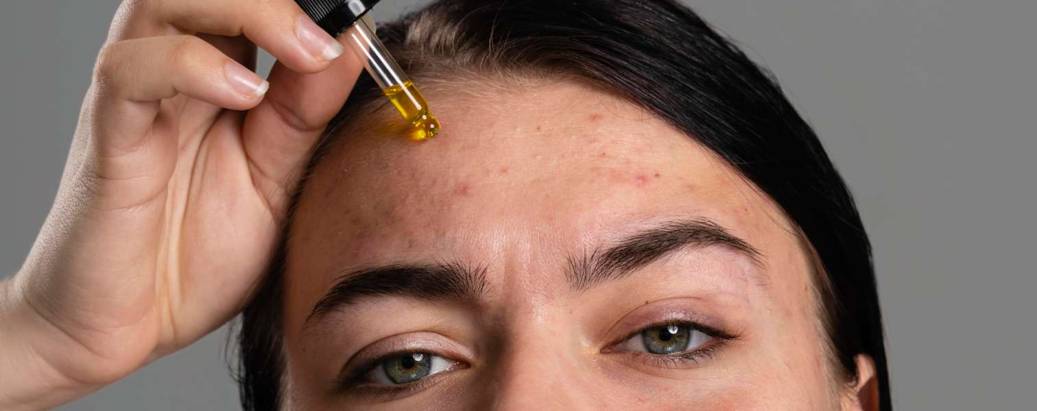 Laser Skin Resurfacing