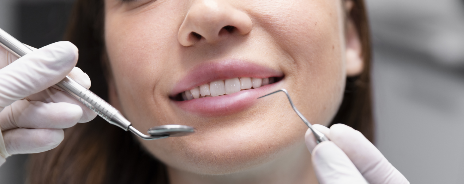 Do I Need Implants or Are Other Options Enough?