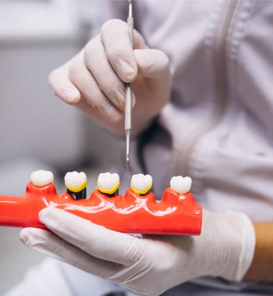 Understanding Dental Crowns: Types and Benefits