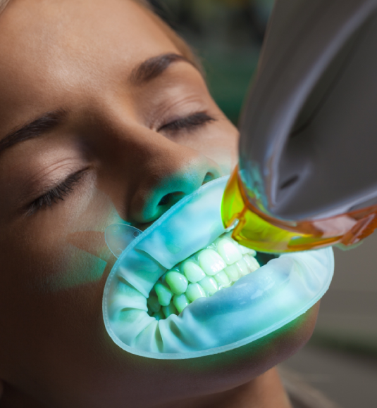 Understanding Professional Teeth Whitening Options in Turkey