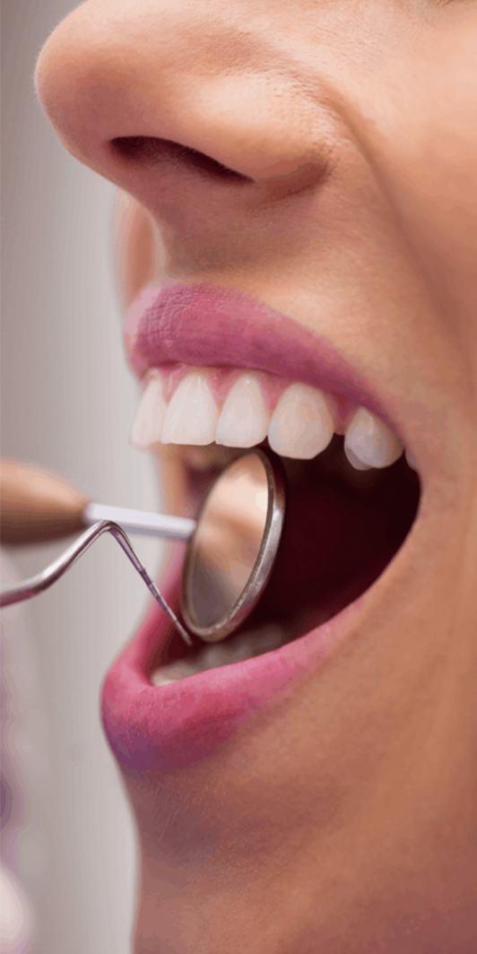 Key Tips for a Smooth PFM Crown Experience in Turkey