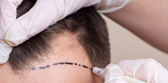 Follow-Up Checks, Washing Routine, and Shedding Phase Timeline