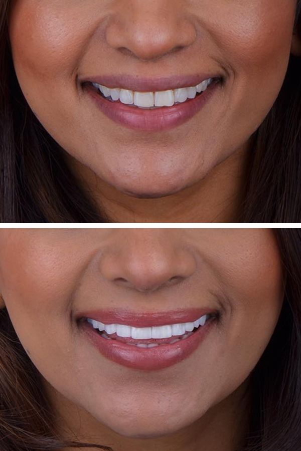 Aslı Tarcan Clinic — case