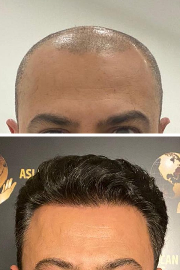 Aslı Tarcan Clinic — case