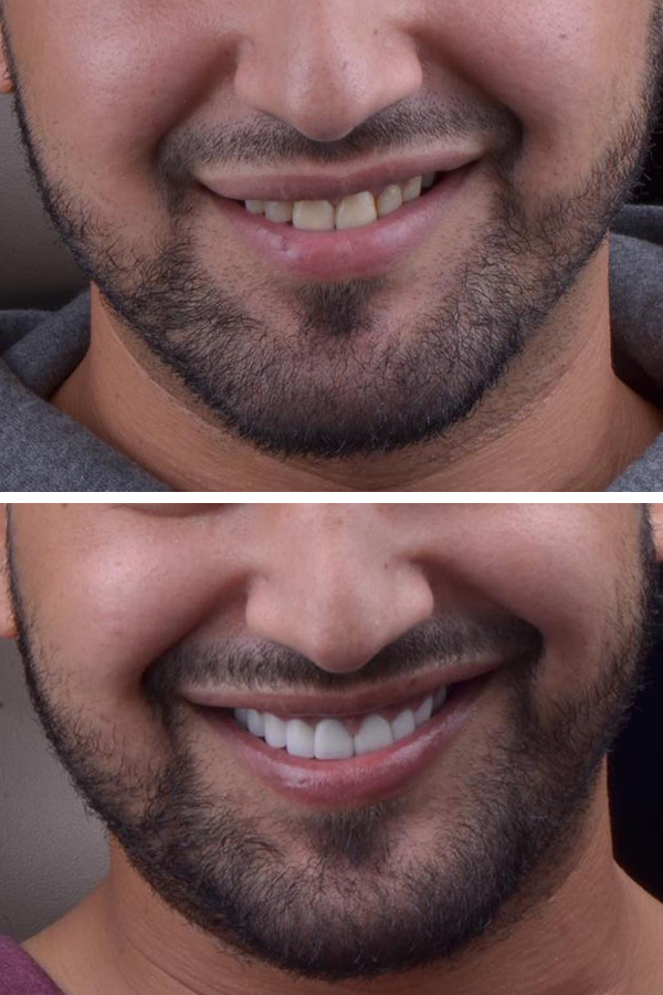 Aslı Tarcan Clinic — case