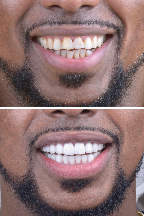 Aslı Tarcan Clinic — case