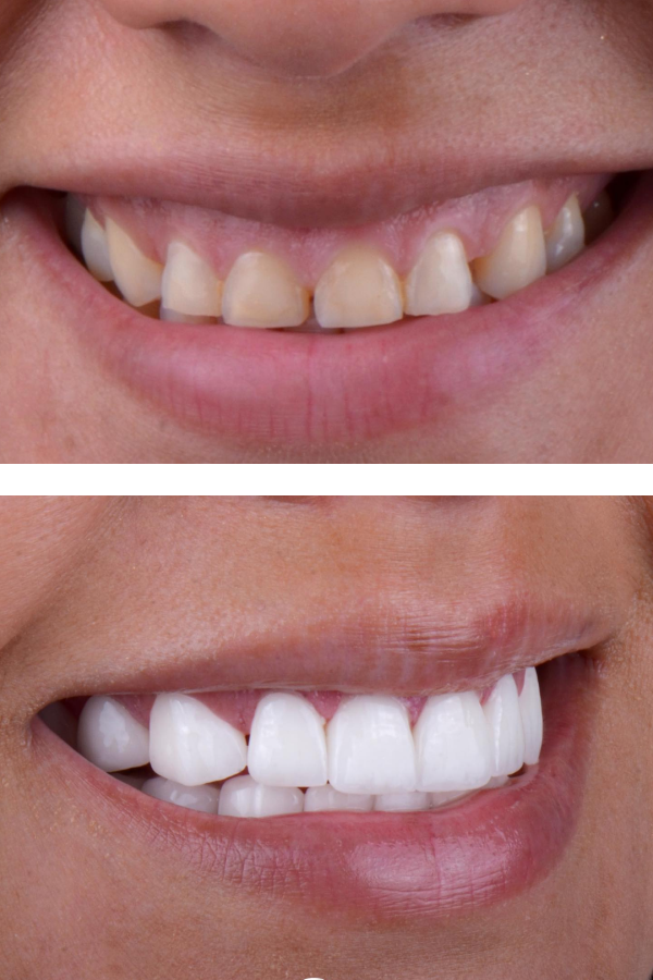 Aslı Tarcan Clinic — case