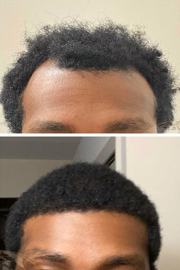 Aslı Tarcan Clinic — case