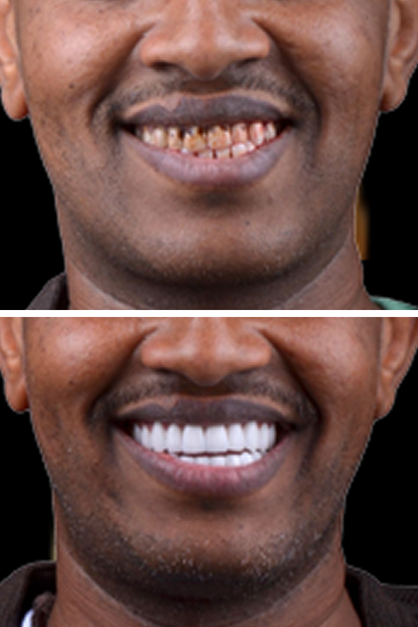 Aslı Tarcan Clinic — case