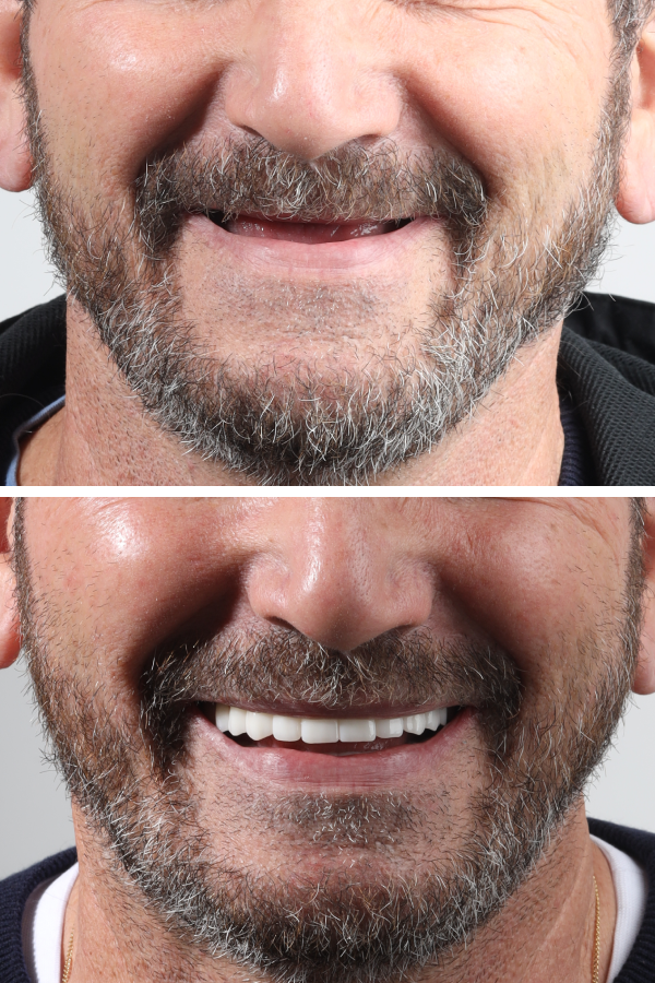 Dentica International — case