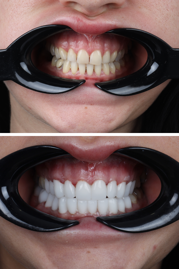 Dentica International — case