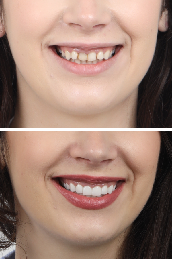 Dentica International — case