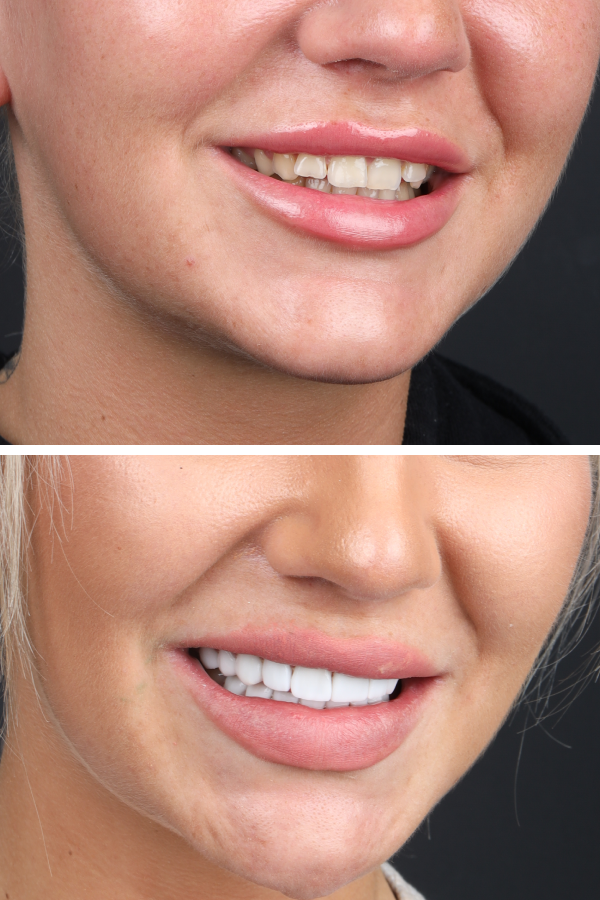 Dentica International — case