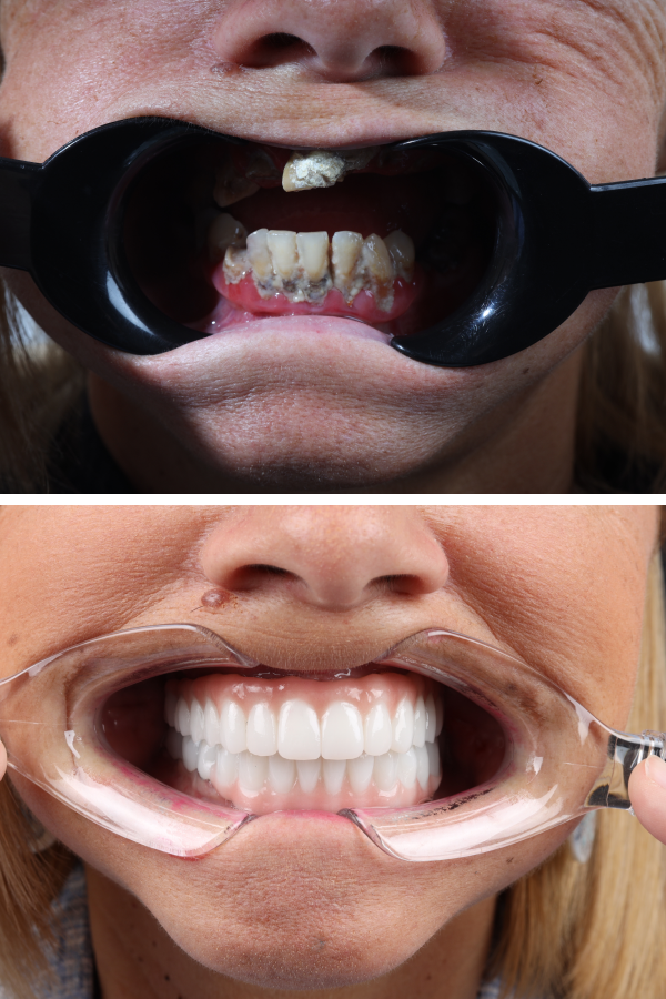 Dentica International — case