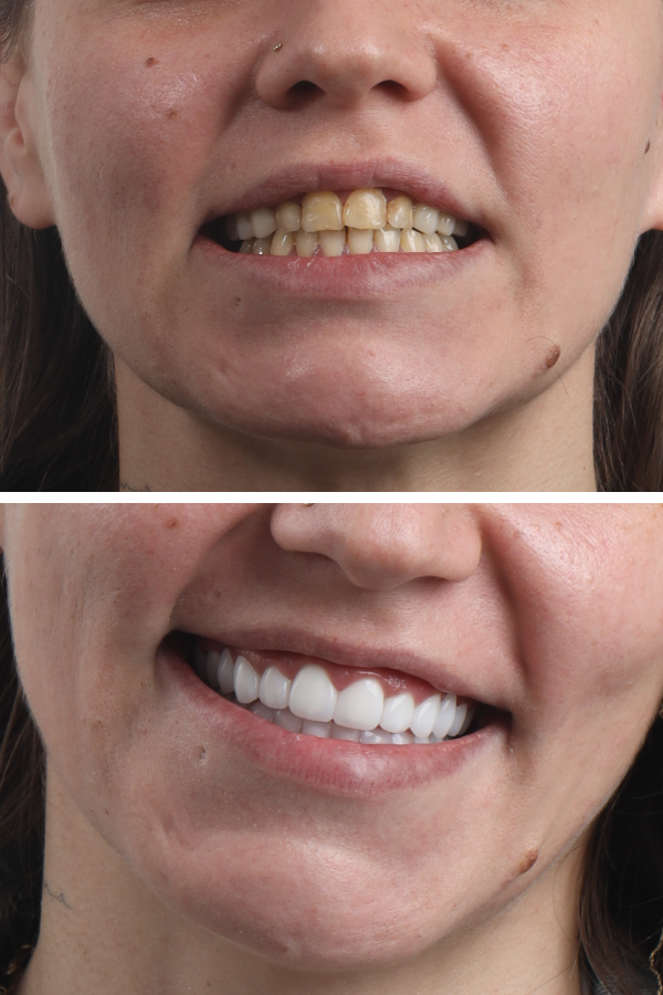 Dentica International — case