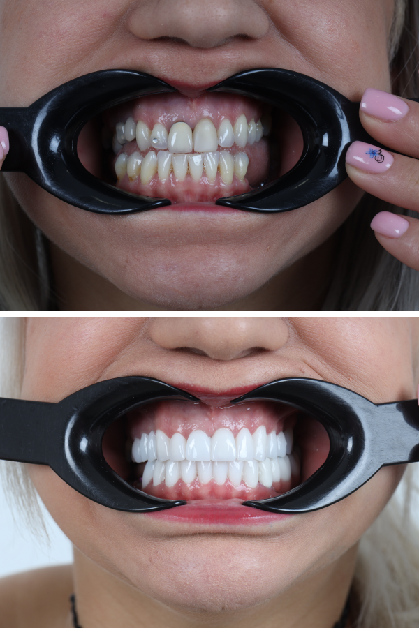 Dentica International — case