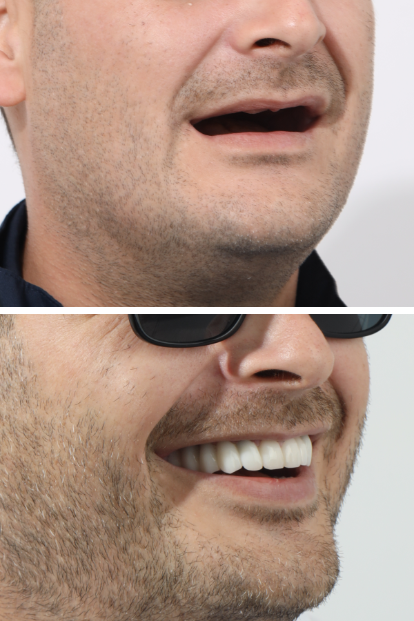 Dentica International — case