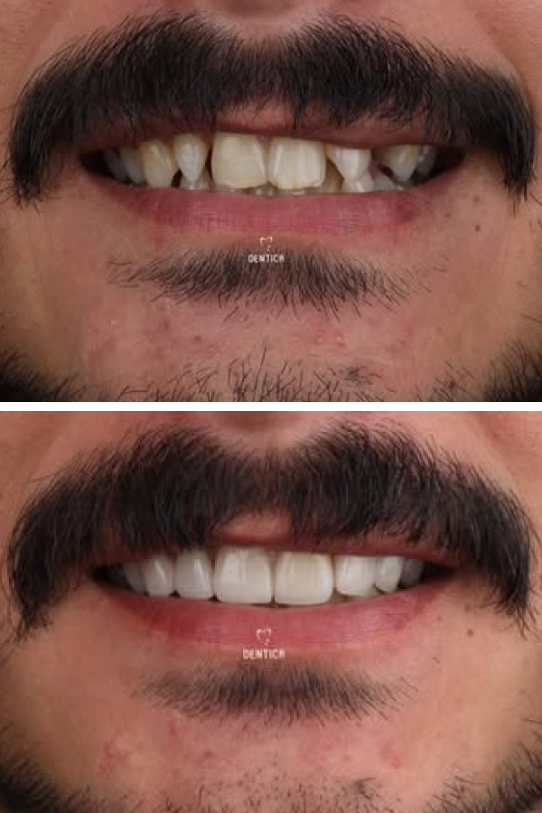 Dentica International — case