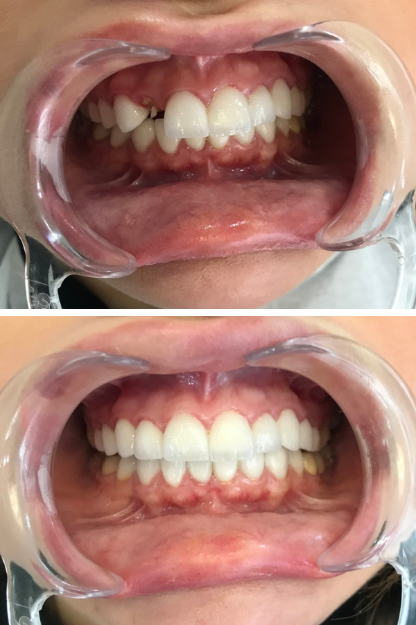 Dentzade Clinic — case