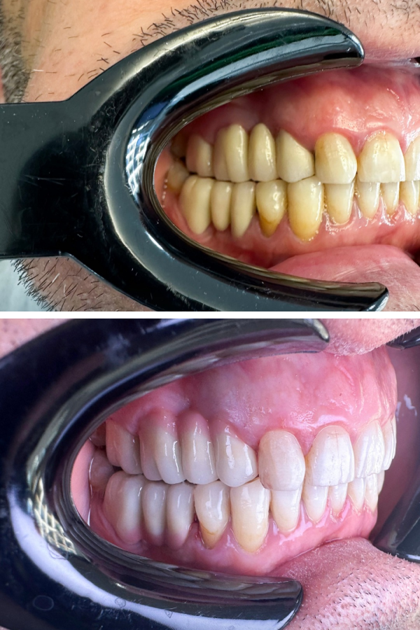 Dentzade Clinic — case