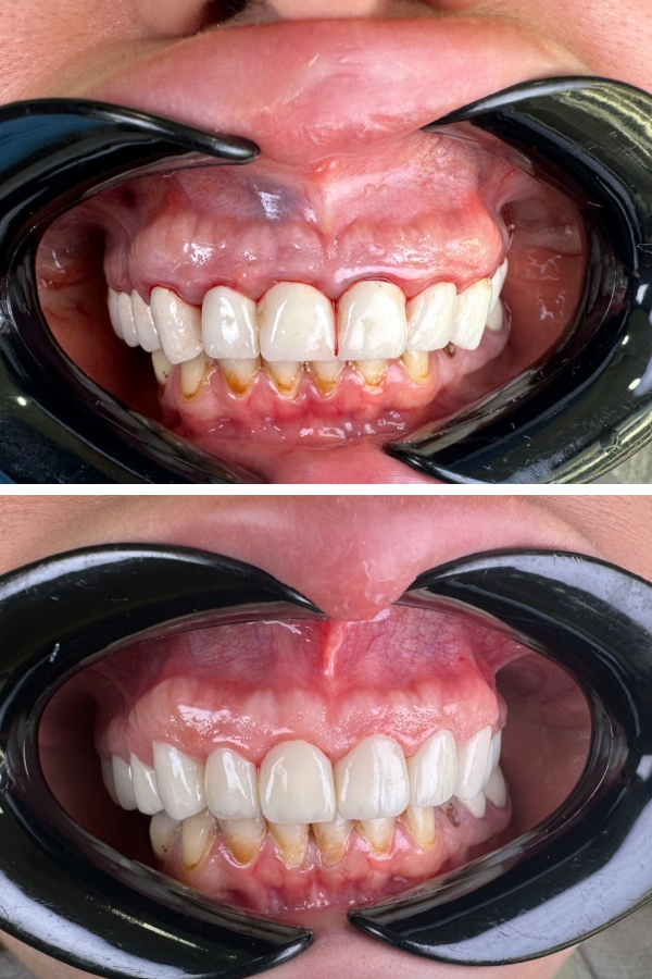 Dentzade Clinic — case