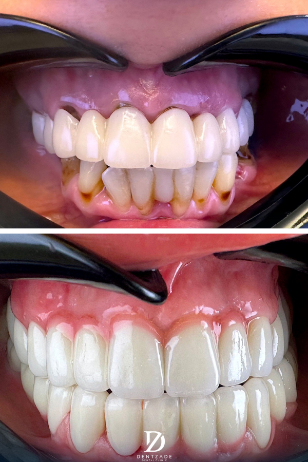 Dentzade Clinic — case