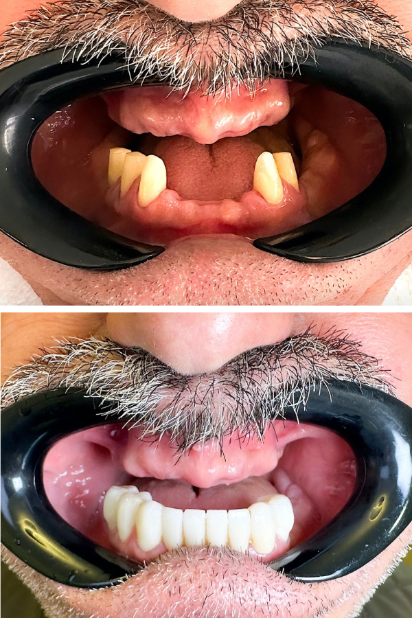 Dentzade Clinic — case
