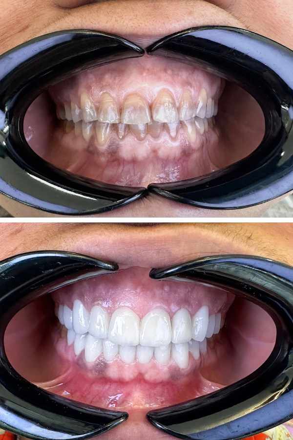 Dentzade Clinic — case