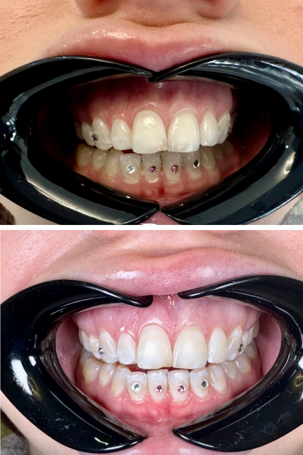 Dentzade Clinic — case