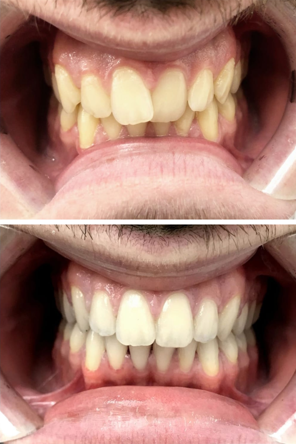 Dentzade Clinic — case