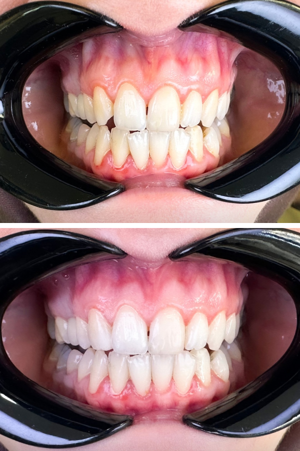 Dentzade Clinic — case