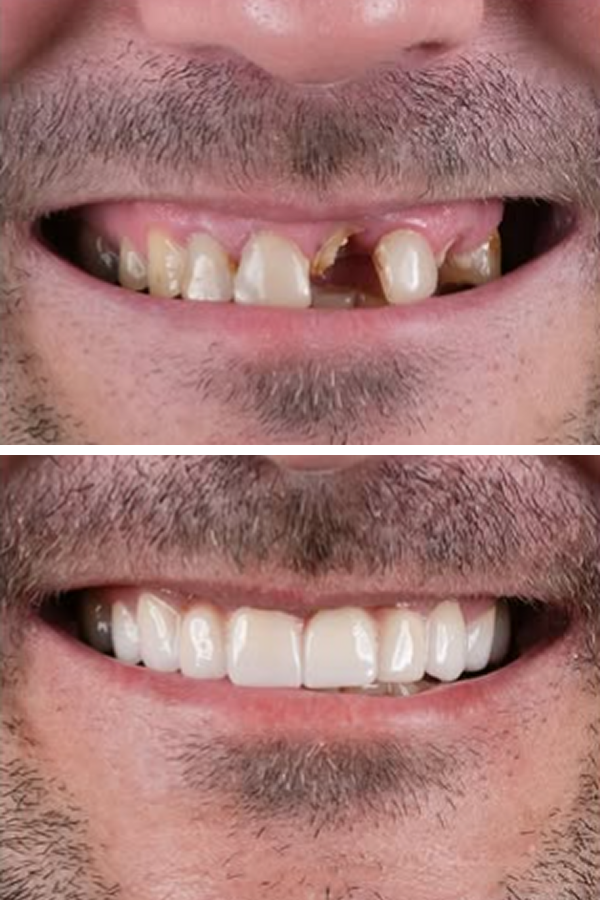 Egedent Clinic — case