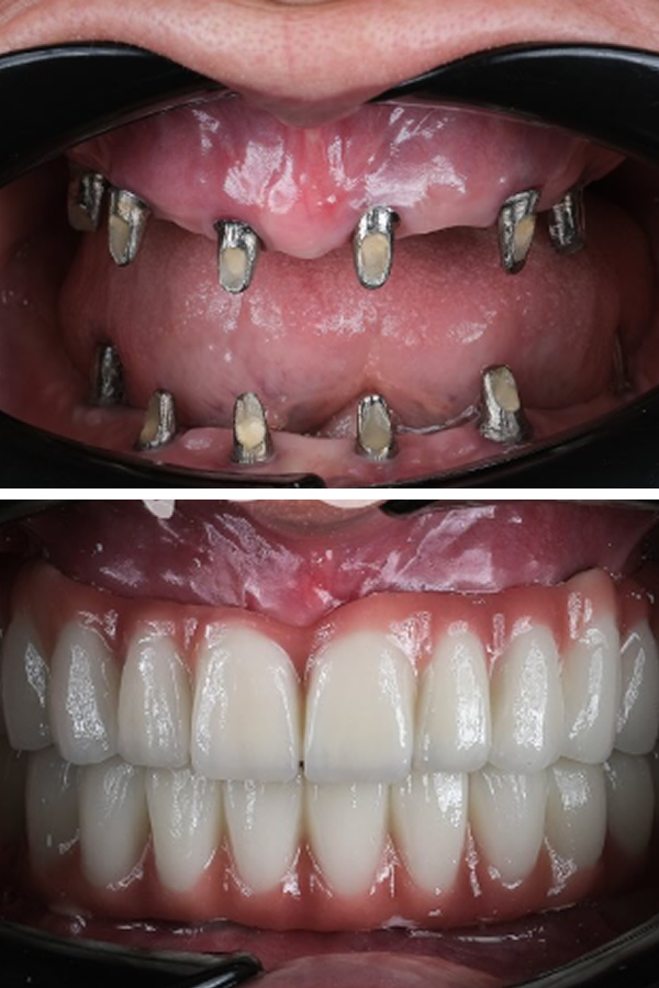 Egedent Clinic — case