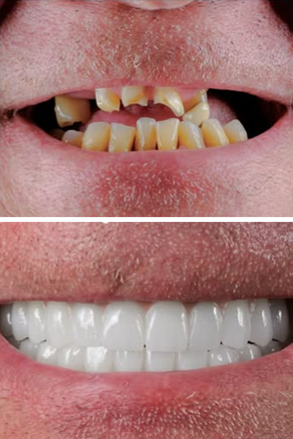 Egedent Clinic — case