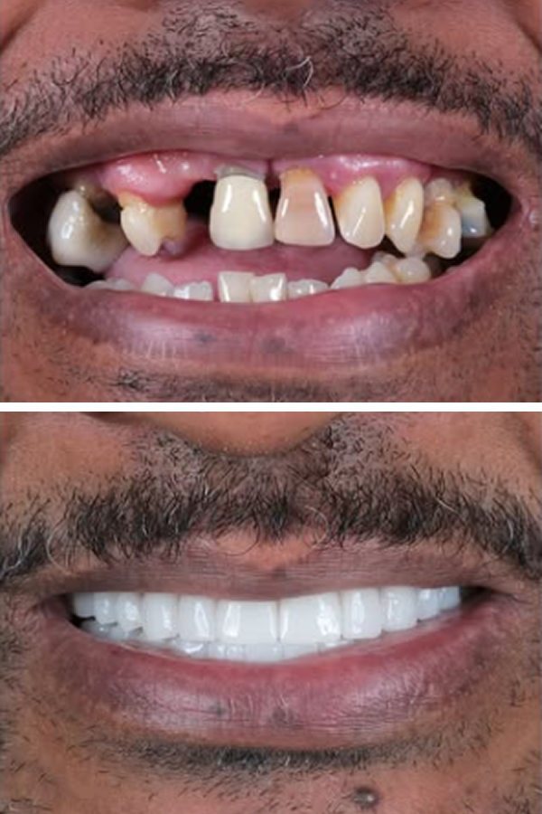 Egedent Clinic — case