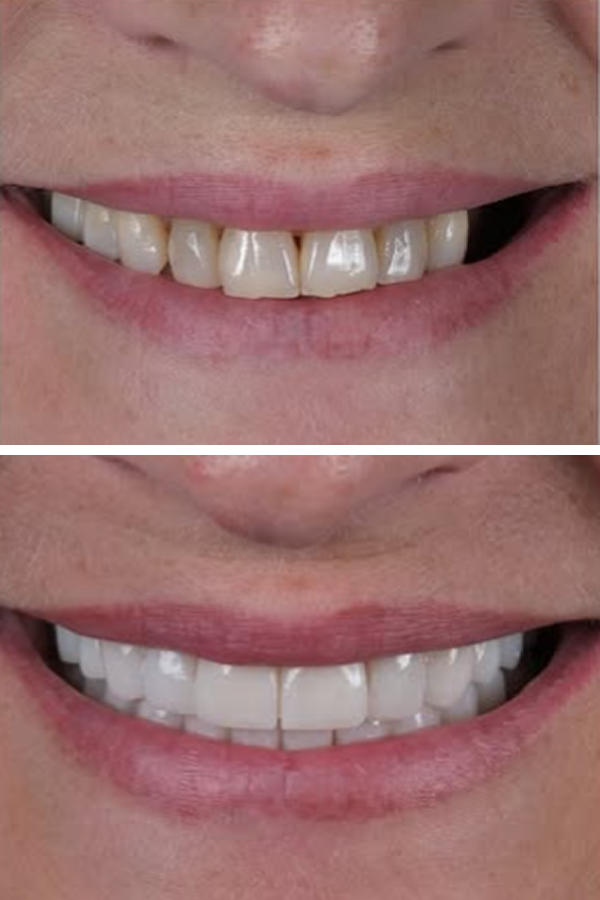 Egedent Clinic — case