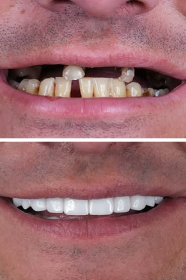 Egedent Clinic — case