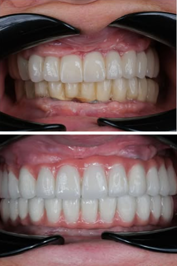 Egedent Clinic — case