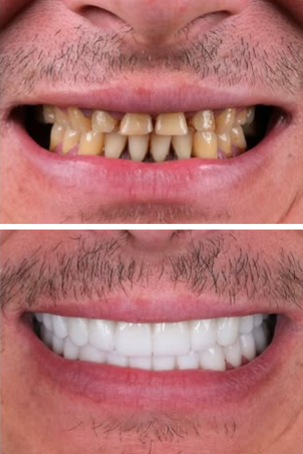 Egedent Clinic — case