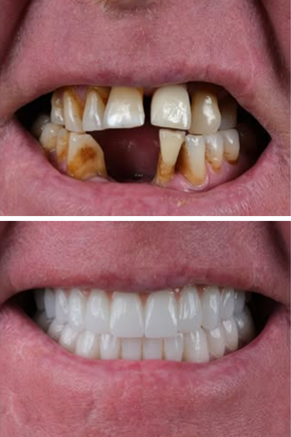 Egedent Clinic — case