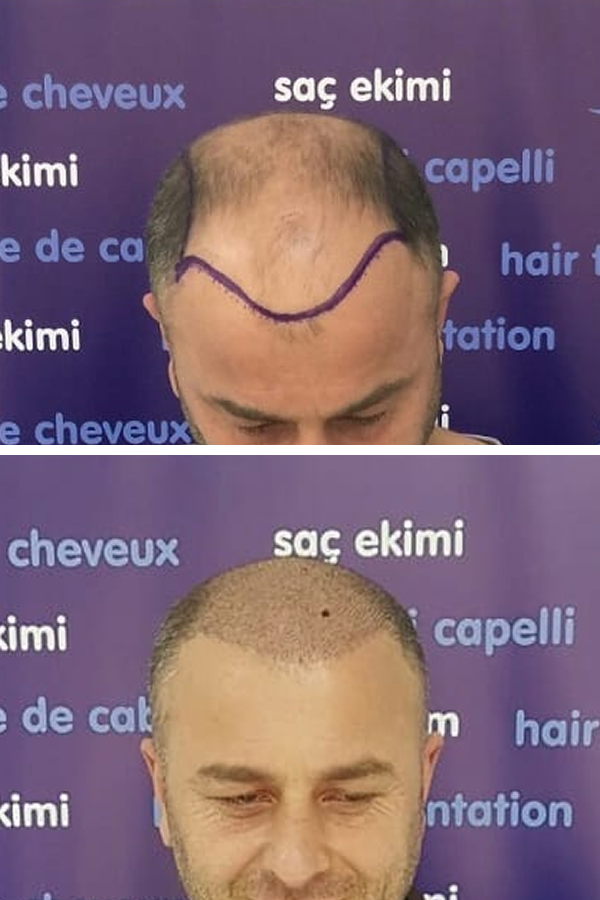 Kardelen Clinic — case