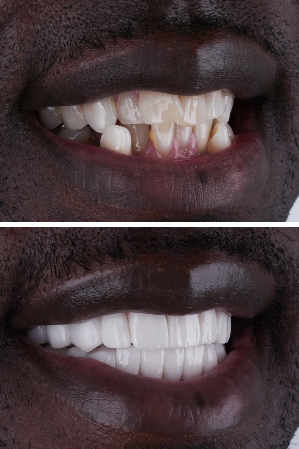 Ömer İstanbul — case