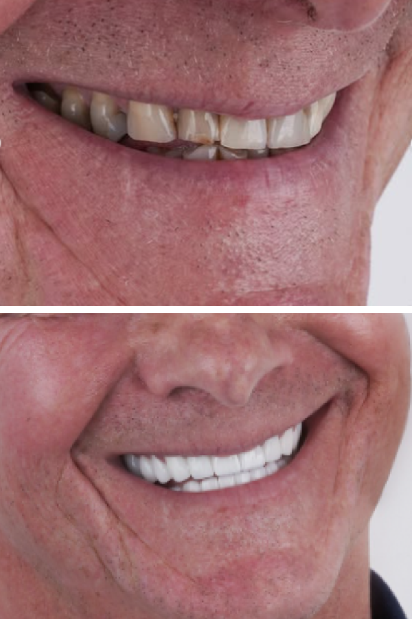 Ömer İstanbul — case