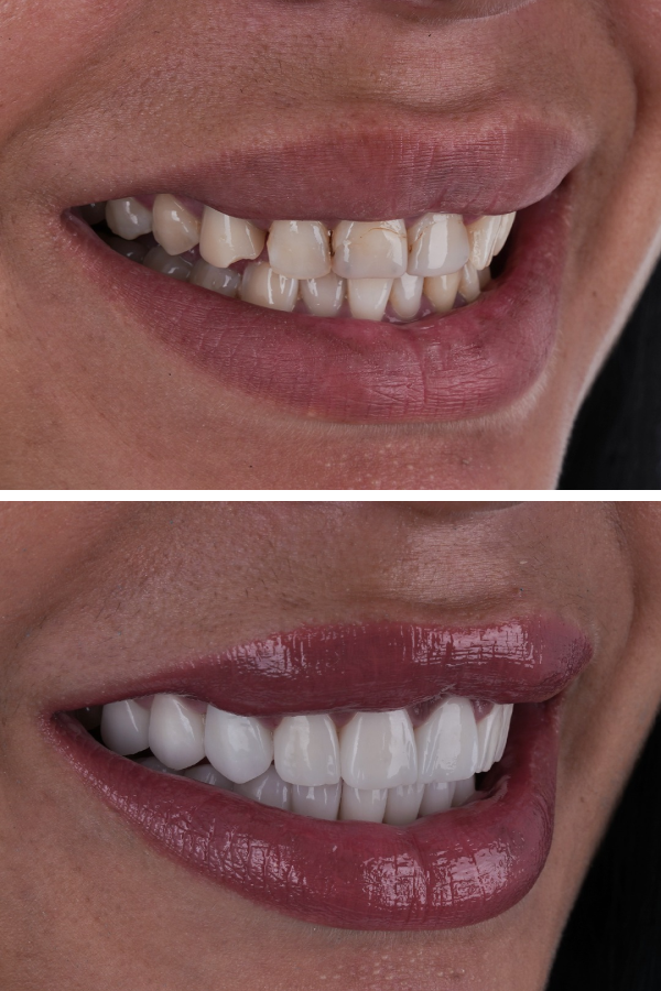 Ömer İstanbul — case