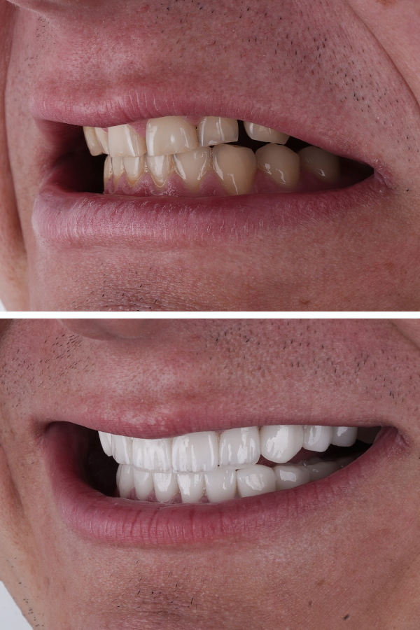 Ömer İstanbul — case