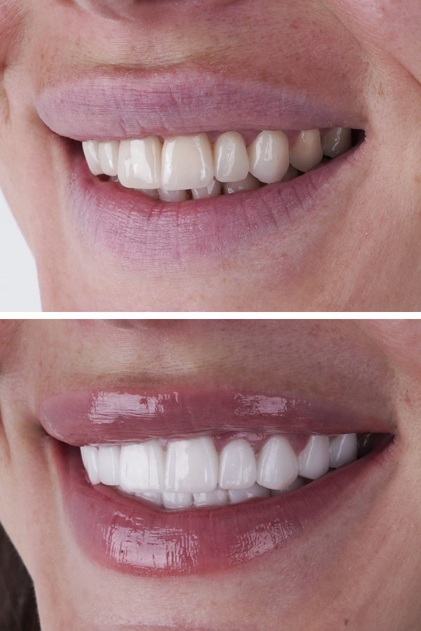 Ömer İstanbul — case