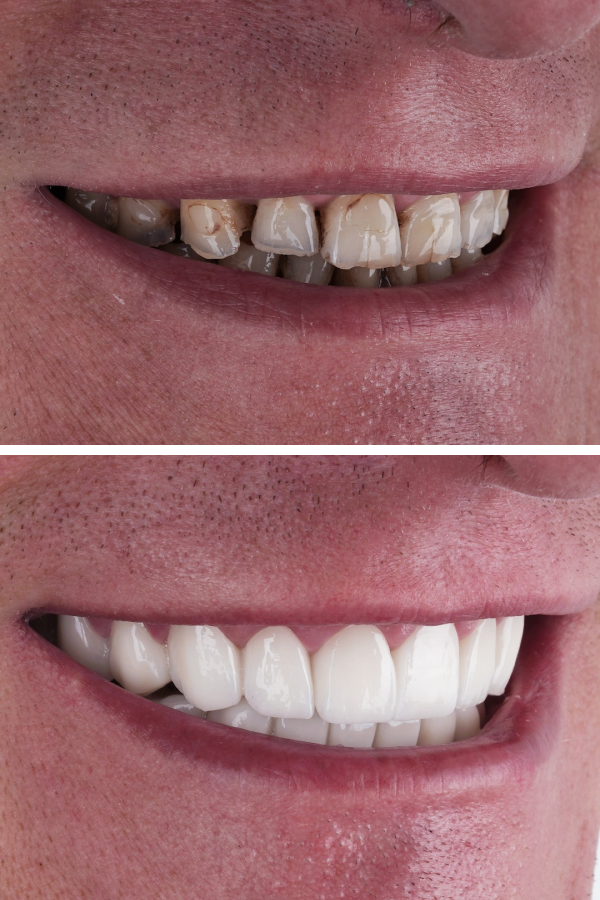 Ömer İstanbul — case